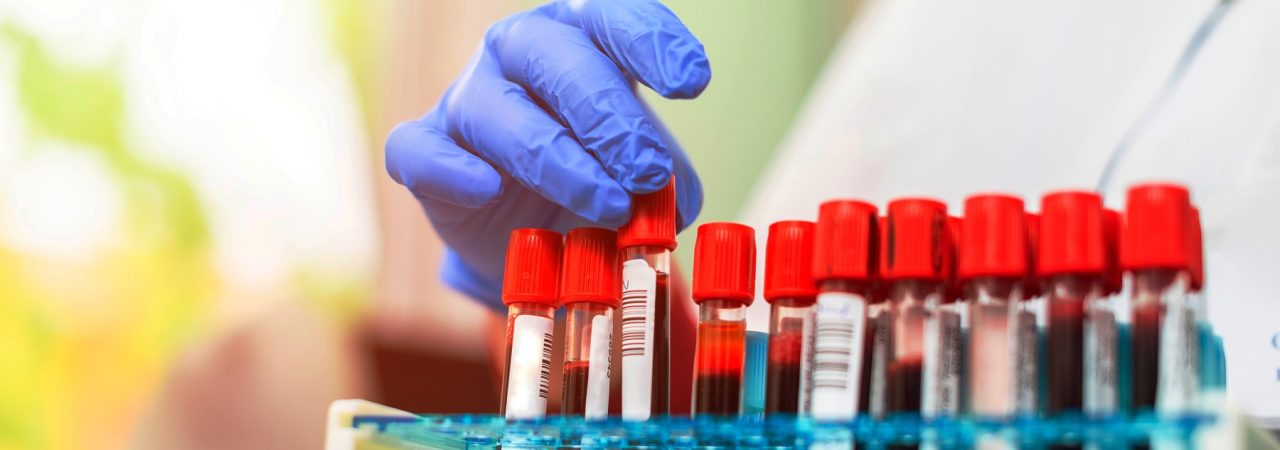 Test-Tubes